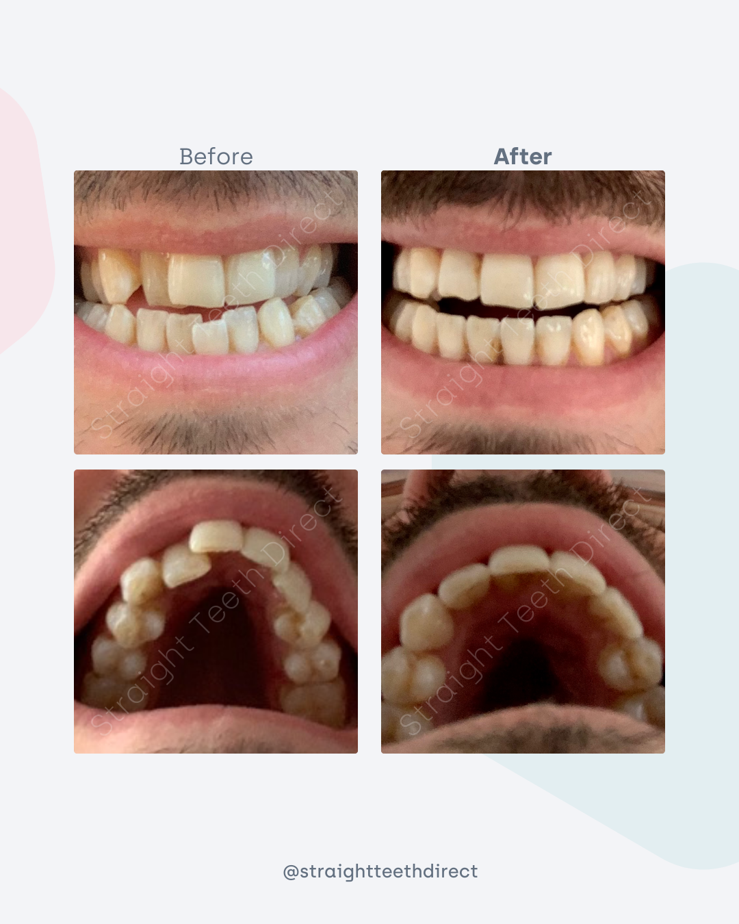 Before and after 3